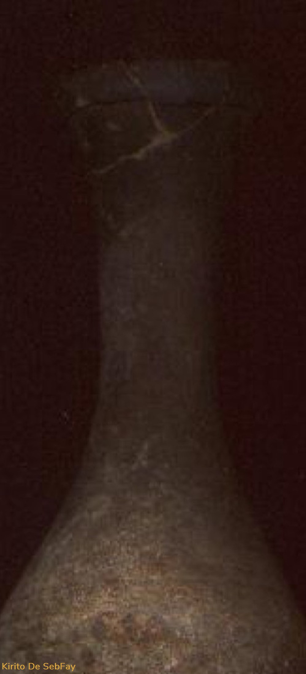 LIGULA ROMAINE IIS. AP. J.-C. 3 art antiquites ligula romaine iis ap j c
