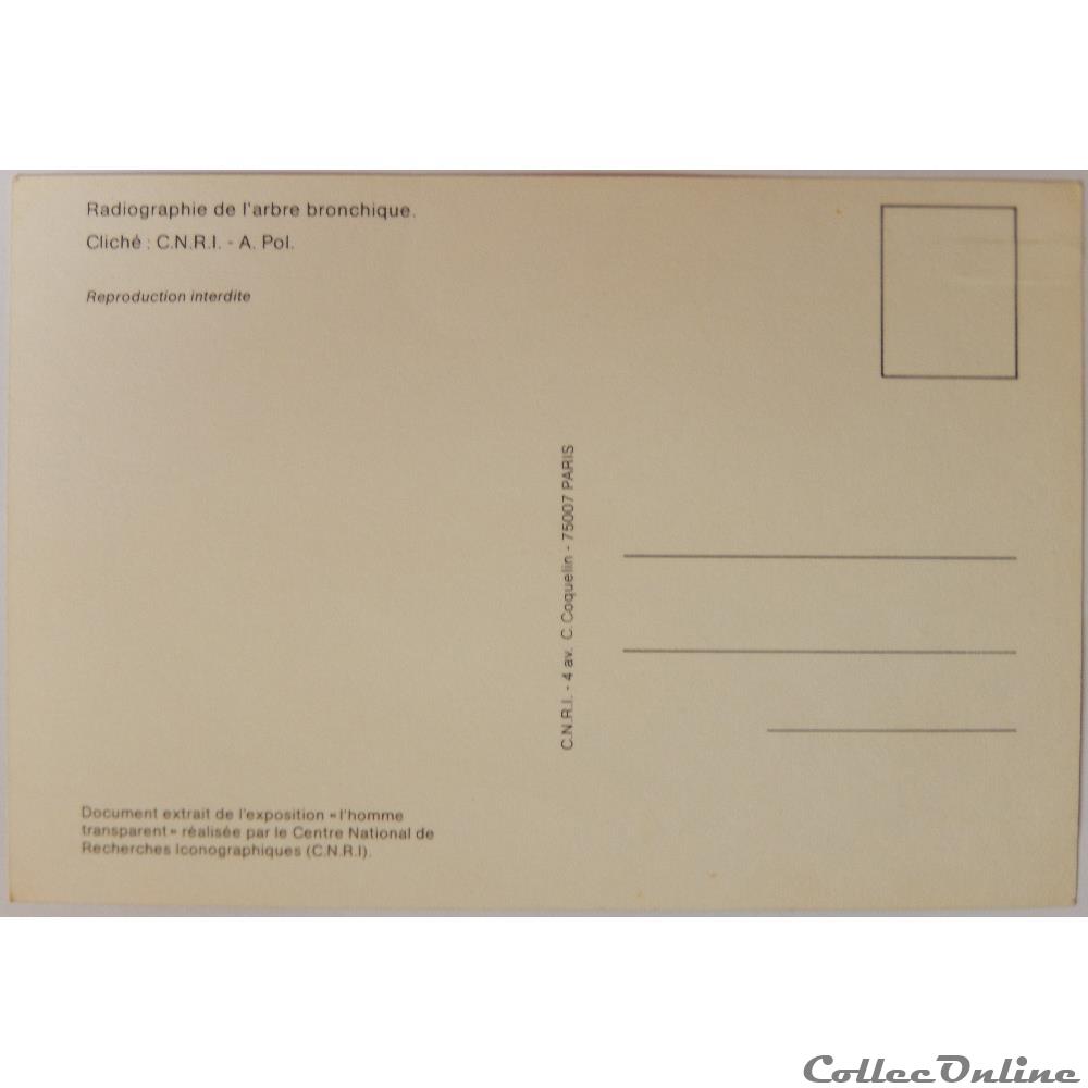 CP radiographie de l'arbre bronchique carte postale europe alsace cp radiographie de arbre bronchique