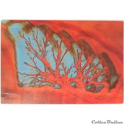 CP radiographie de l'arbre bronchique
