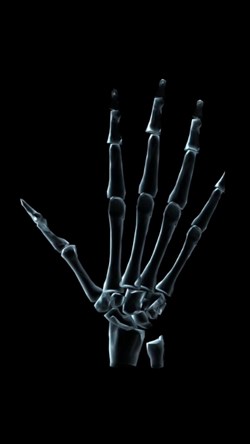 Video skeleton 4