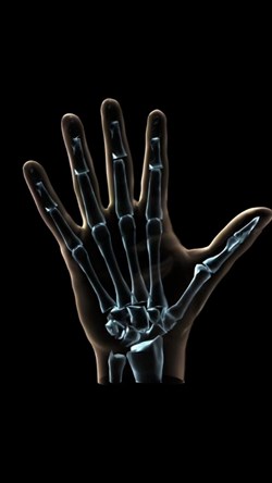 Video skeleton 3