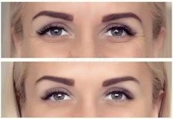 Cosmetic Procedures
