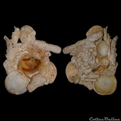 Xenophoridae - Xenophora conchyliophora (Born, 1780)